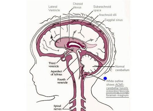 blog-post-image